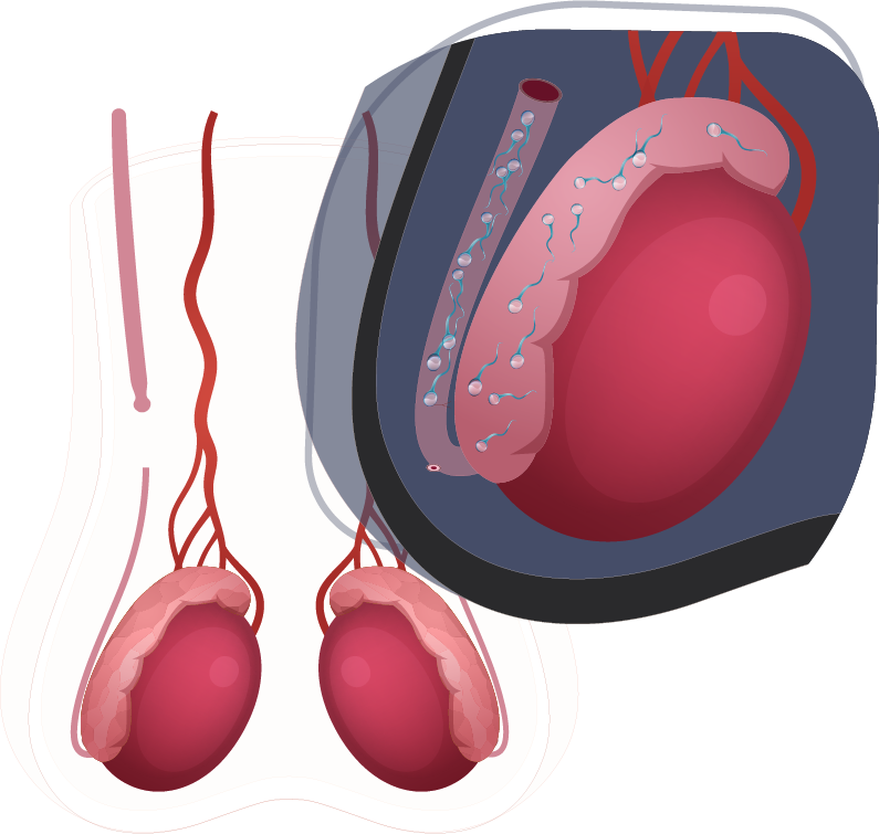 Vasectomia